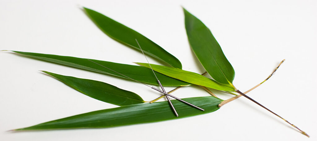 TCM München – Stressbalance & feminine Vitalität 3 Akupunktur München