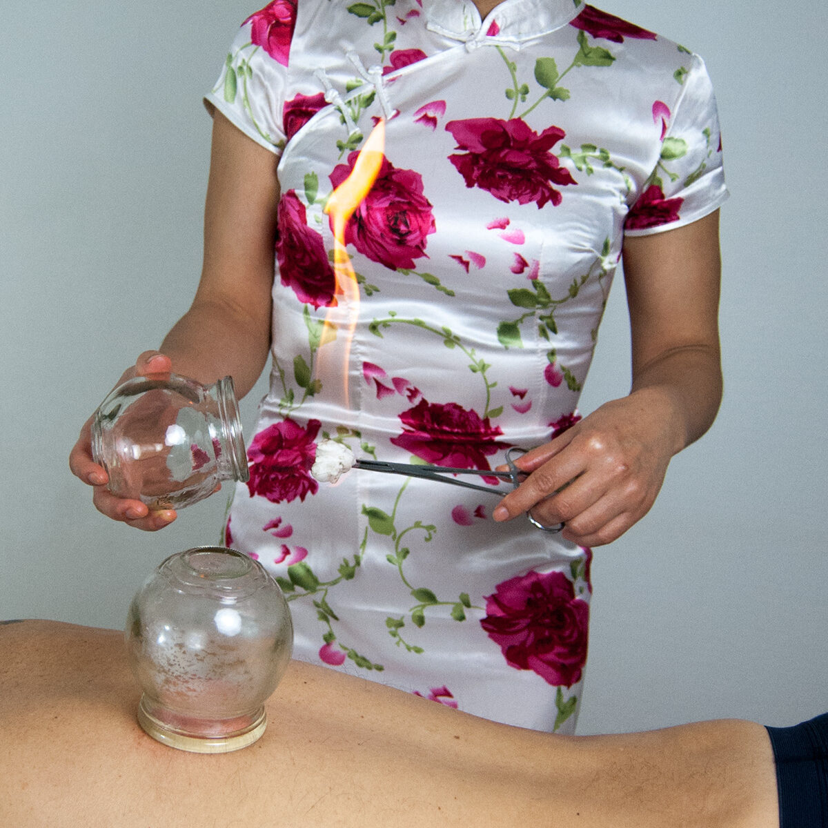 TCM München, Naturheilpraxis für Traditionelle Chinesische Medizin und Akupunktur 21 Schröpfen